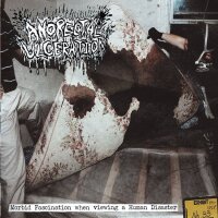 ANORECTAL ULCERATION - Morbid Fascination When Viewing A Human Disaster CD